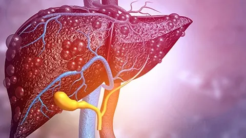 Anatomski prikaz ljudske jetre s vidljivim krvnim žilama i oštećenjima