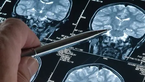 Ruka liječnika koja srebrnom olovkom pokazuje na MRI snimke mozga