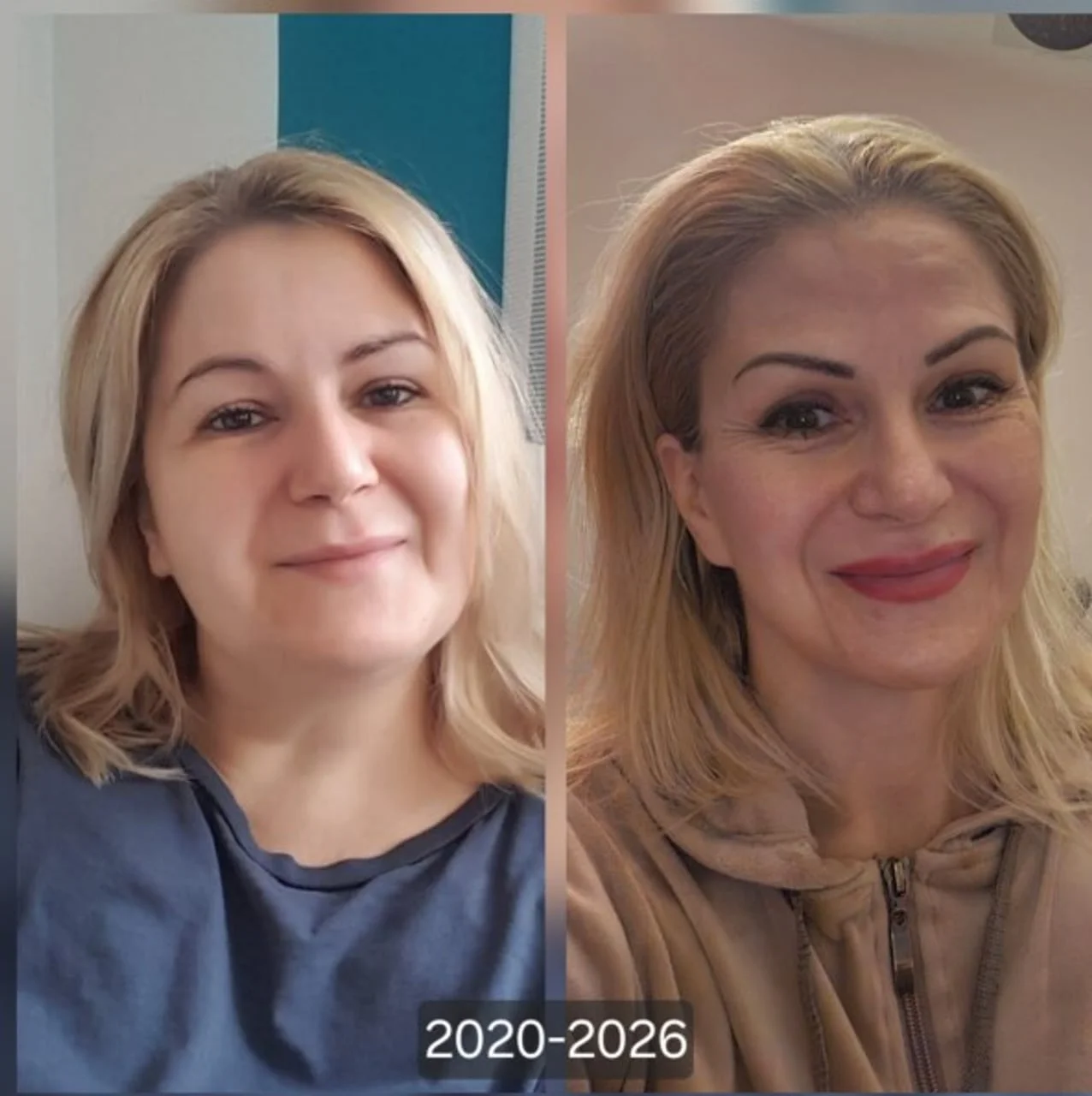 Usporedba dva portreta lica Adele Franceković iz 2020. i 2026. godine