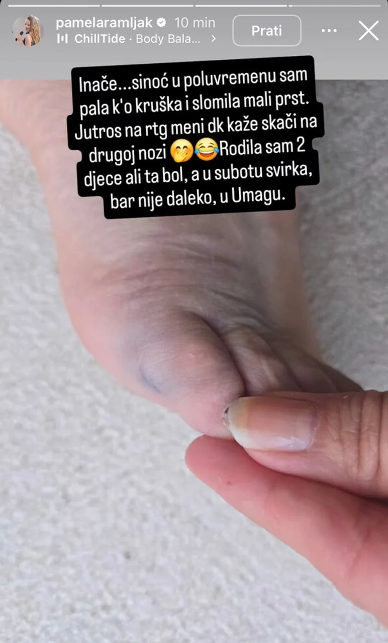 Krupni plan ozljedjenog prsta na nozi uz tekst objave