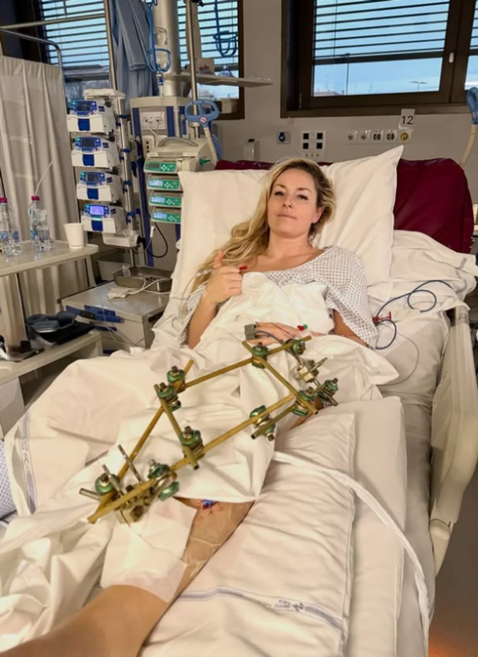 Lindsey Vonn s fiksatorom na nozi pokazuje podignuti palac u bolnici