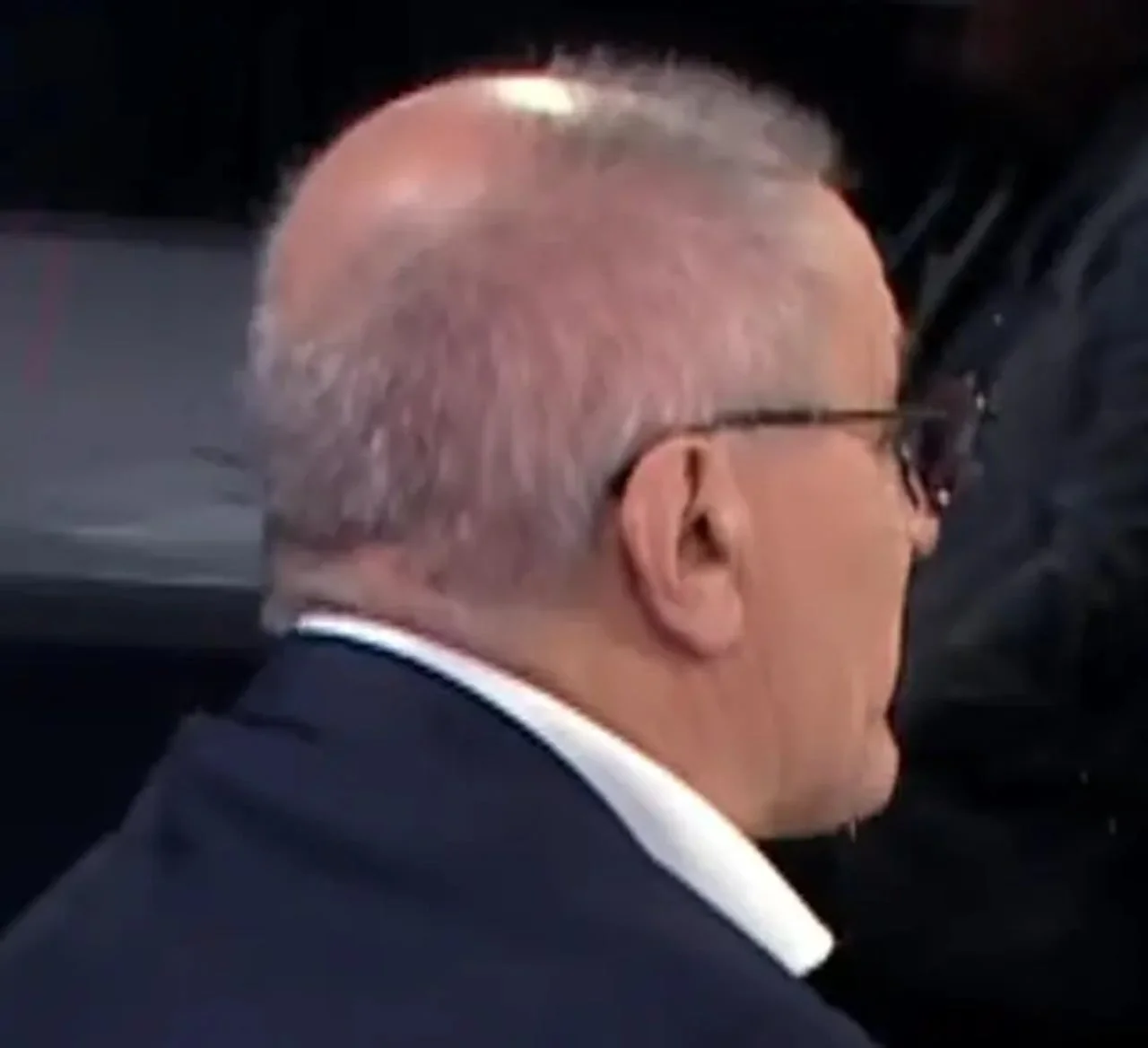 Pogled s leđa na tjeme Zdravka Mamića nakon estetskog zahvata.