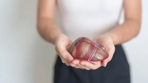 Osoba drži anatomski model ljudske jetre s vidljivim oštećenjima.