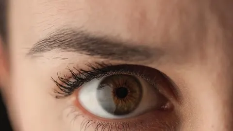Krupni plan ženskog oka s naglašenim tamnim podočnjacima.