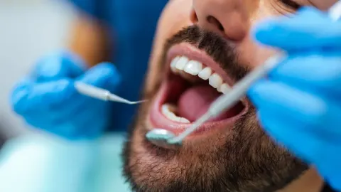 Stomatološki pregled zubi i desni pacijenta s bradom pomoću ogledala