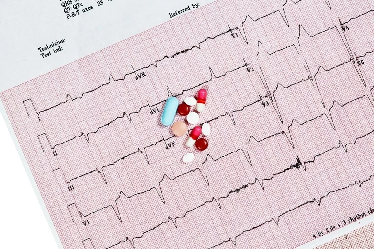 Različite tablete položene na papir s EKG nalazom